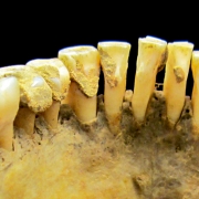 دندان 40 هزار ساله